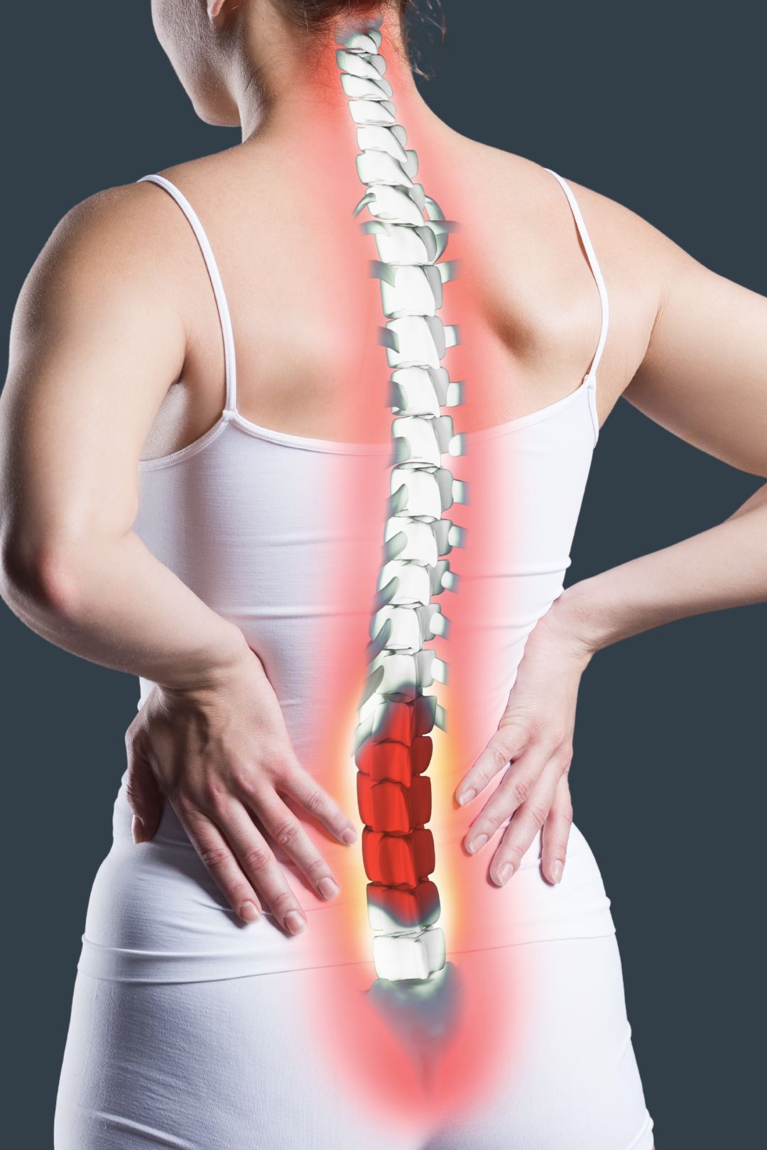 Sciatica